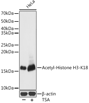 Anti-Acetyl-Histone H3-K18 Pol