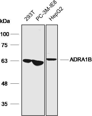 Anti-ADRA1B Polyclonal Antibod