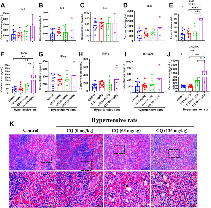 LabEx Luminex平台助力氯喹治疗COVID-19的潜力探索