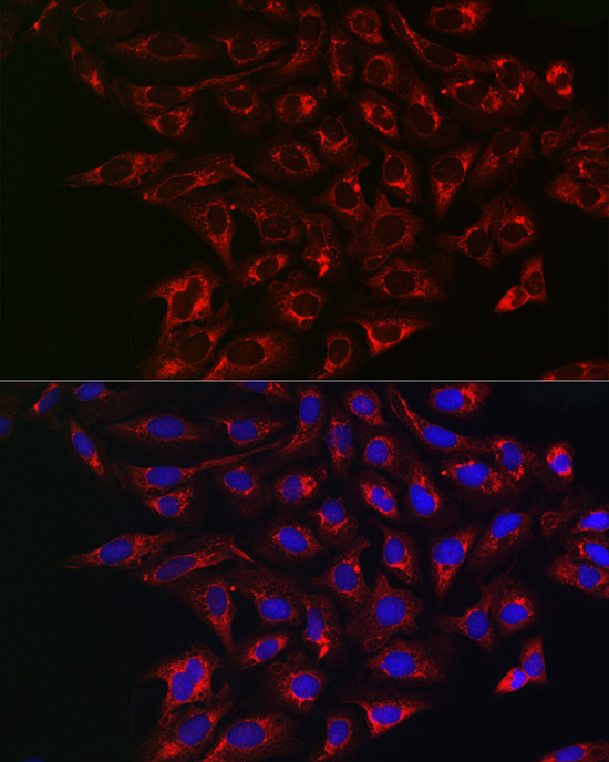 Anti-ABCG2 Polyclonal Antibody