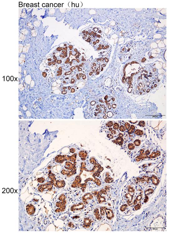 Anti-ADAM15 Polyclonal Antibod