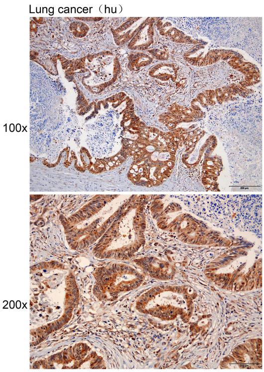 Anti-ADAM21 Polyclonal Antibod
