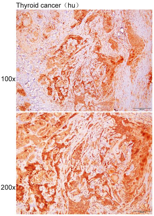 Anti-ACVR2B Polyclonal Antibod