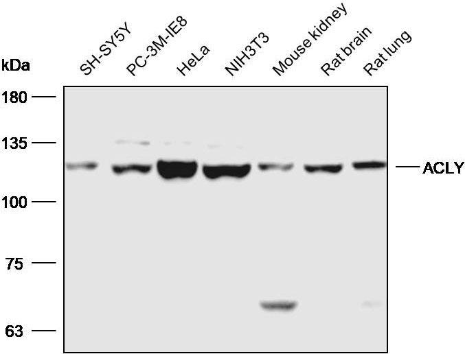 Anti-ACLY Polyclonal Antibody