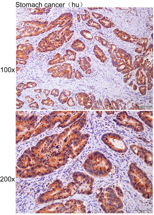 Anti-ADAMTS17 Polyclonal Antib