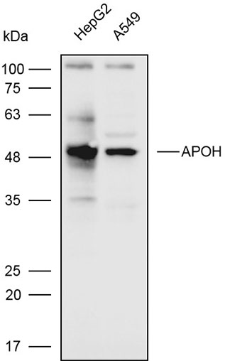 Anti-ACVR2B Polyclonal Antibod