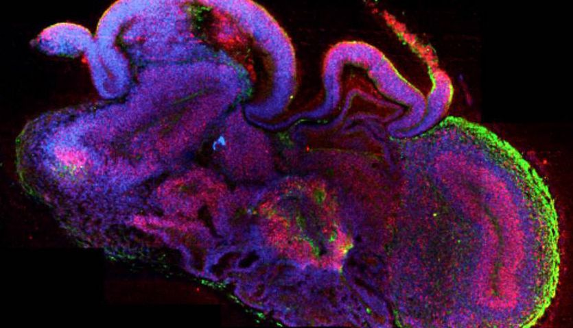 类器官实验：生物医学研究的新前沿
