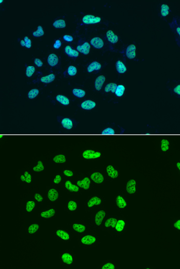 Anti-Acetyl-Histone H3-K9 Poly