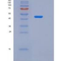 人脂蛋白关联磷脂酶A2(LpPLA2)重组蛋白His Tag
