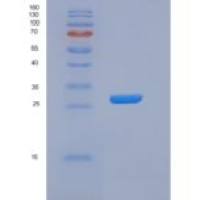 人泛素羧基端酯酶L3(UCHL3)重组蛋白His tag