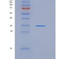 人SULT1B1重组蛋白His Tag