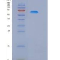 人Glypican 3 / GPC3 / OCI-5重组蛋白His tag
