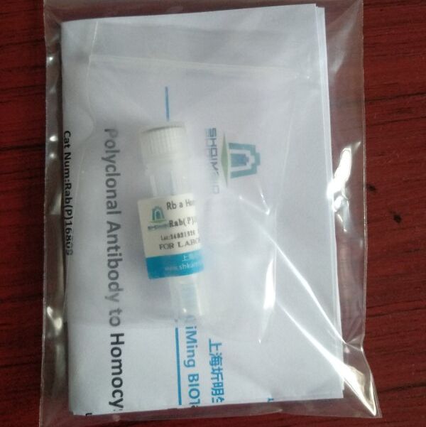 兔抗人ABCB7多克隆抗体(ELISA,IHC,WB)