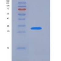 人甲状旁腺激素(PTH)重组蛋白aa 32-65, GST tag