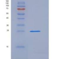 人叶酸受体1(FOLR1)重组蛋白His Tag