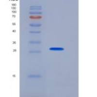 人KLK3 / PSA / Kallikrein-3重组蛋白His tag