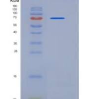 人LRRN3重组蛋白His tag