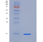 小鼠ACVR2A / ActrIIa重组蛋白His tag