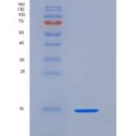 小鼠ACVR2A / ActrIIa重组蛋白His tag