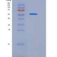 大鼠基底细胞粘附分子(BCAM)重组蛋白His tag