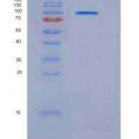 人CD10 / Neprilysin / MME重组蛋白Fc tag