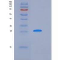 人激肽释放酶8(KLK8)重组蛋白His tag