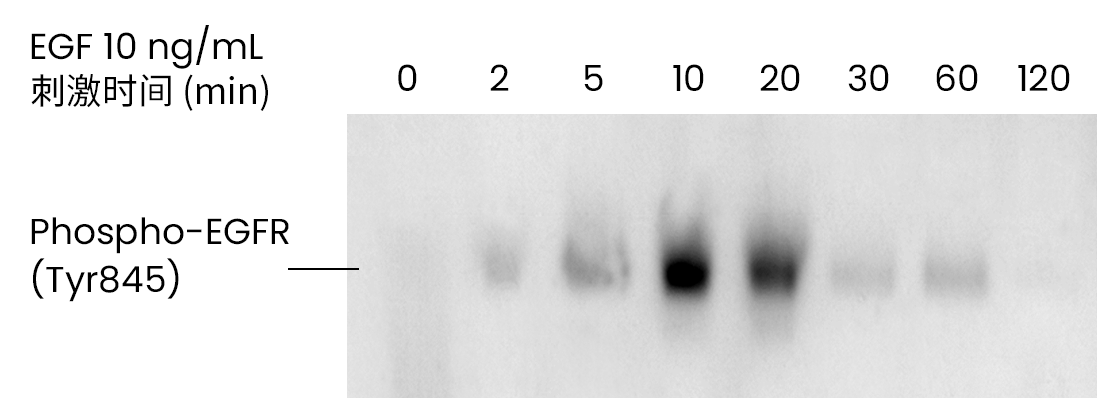蛋白磷酸化研究和选对抗体究竟是什么关系？