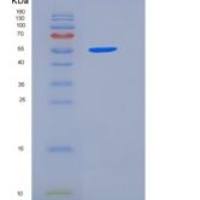 小鼠DLL4 / Delta4重组蛋白His tag