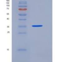 人信号调节蛋白γ(SIRPg)重组蛋白His Tag