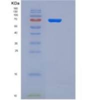 人Semaphorin 4A / SEMA4A / Semaphorin B重组蛋白His tag