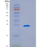 人B-细胞淋巴瘤因子2(Bcl2)重组蛋白His tag