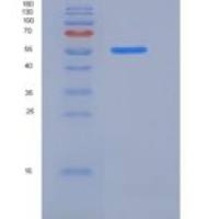 人GBA3 / CBGL1 重组蛋白His tag