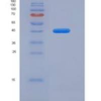 人Mucin-1 / MUC-1重组蛋白Fc tag