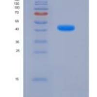 小鼠LY-96 / ESOP-1重组蛋白Fc tag