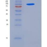 人Semaphorin 4A / SEMA4A / Semaphorin B重组蛋白Fc tag