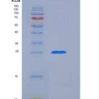 大鼠ASAM / CLMP重组蛋白His tag