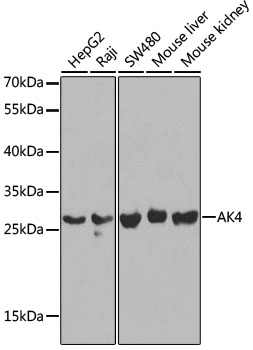 Anti-AK4 Polyclonal Antibody