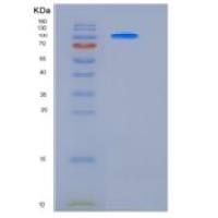 小鼠beta-Catenin / CTNNB1重组蛋白His & GST tag