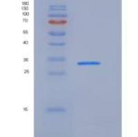 人Low Affinity Fc Epsilon RII重组蛋白
