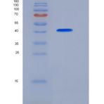 人FCGRT & B2M Heterodimer重组蛋白