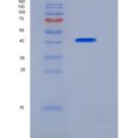 人FCGRT & B2M Heterodimer重组蛋白