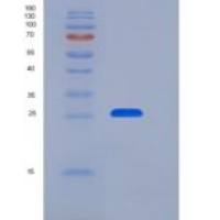 大鼠白介素21受体(IL21R)重组蛋白His tag