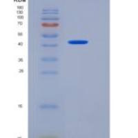 大鼠胃蛋白酶原C(PGC)重组蛋白His tag