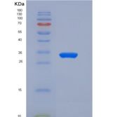 人CEACAM6 / CD66c重组蛋白His tag