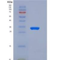 人CEACAM6 / CD66c重组蛋白His tag