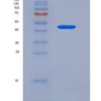 人鳞状细胞癌抗原1(SERPINB3)重组蛋白His Tag