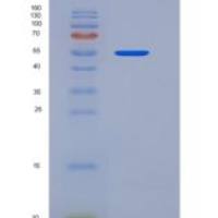 人CLEC10A / MGL1 / CD301重组蛋白Fc tag