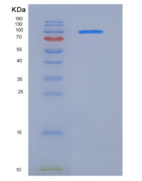 人VEGFR3 / FLT4重组蛋白Fc tag