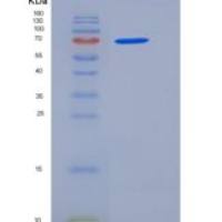 人唾液酸结合Ig样凝集素5(SIGLEC5)重组蛋白Fc tag