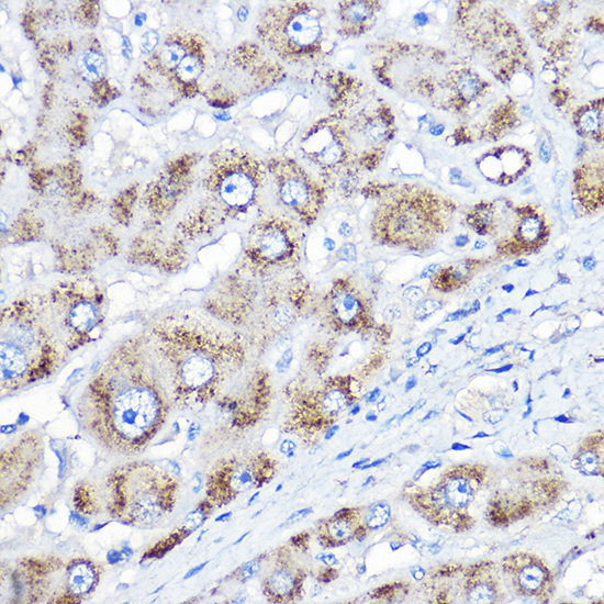 Anti-AGXT Polyclonal Antibody